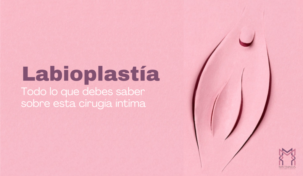 Labio-1